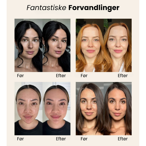 Meroda - Selvtilpassende foundation